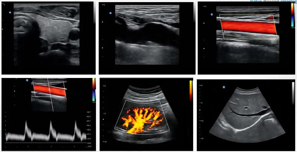 Color Doppler System Display 4