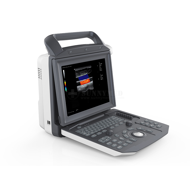 Sya-M5 3D 4D Color Doppler Laptop Cardiac Ultrasound System