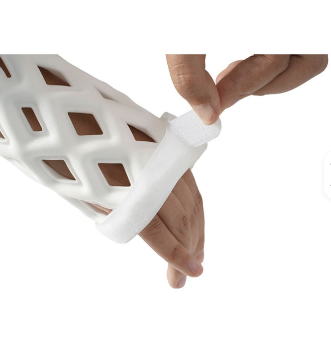 Portable Hand External Fixation System for Trauma and Orthopedic Surgery Orthopedic External Fixation Splint