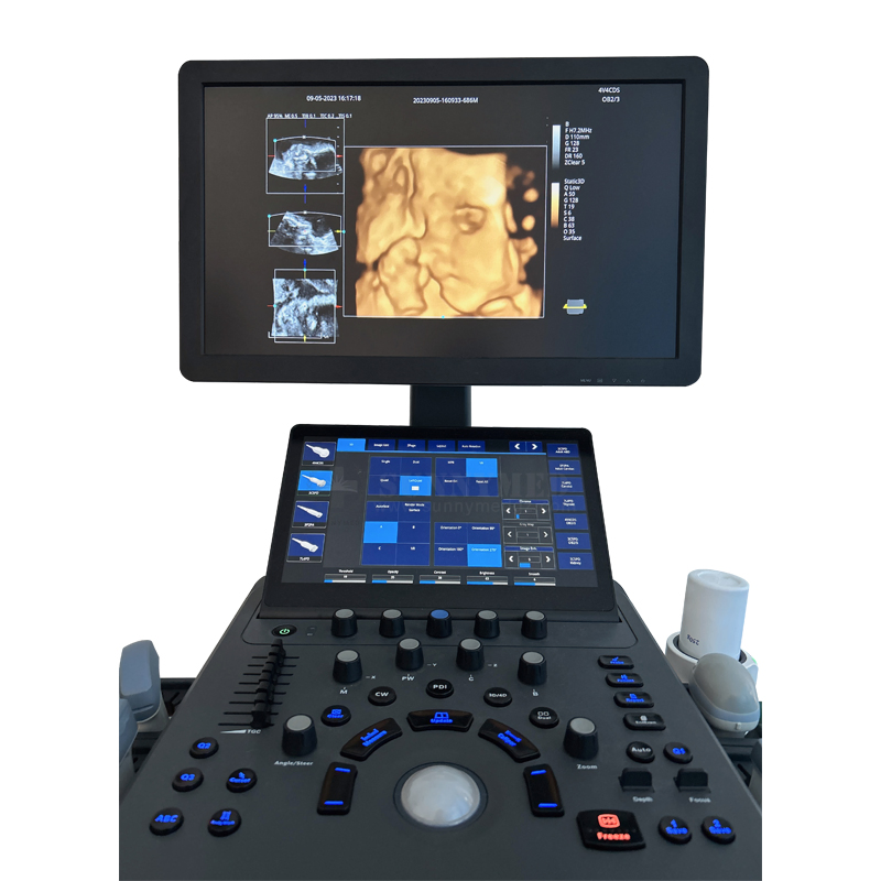 Sya-D40 Obstetrics 4D Gynecology 4 Activated Transducer Ports Color Doppler Ultrasound System