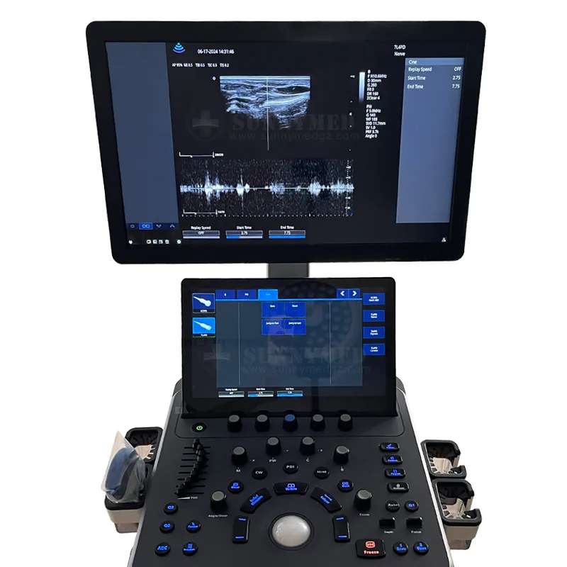 SYA-D40 Ultrasound System
