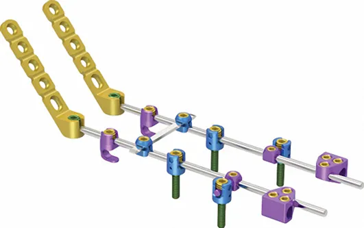 Orthopedic Implants Crosslinks