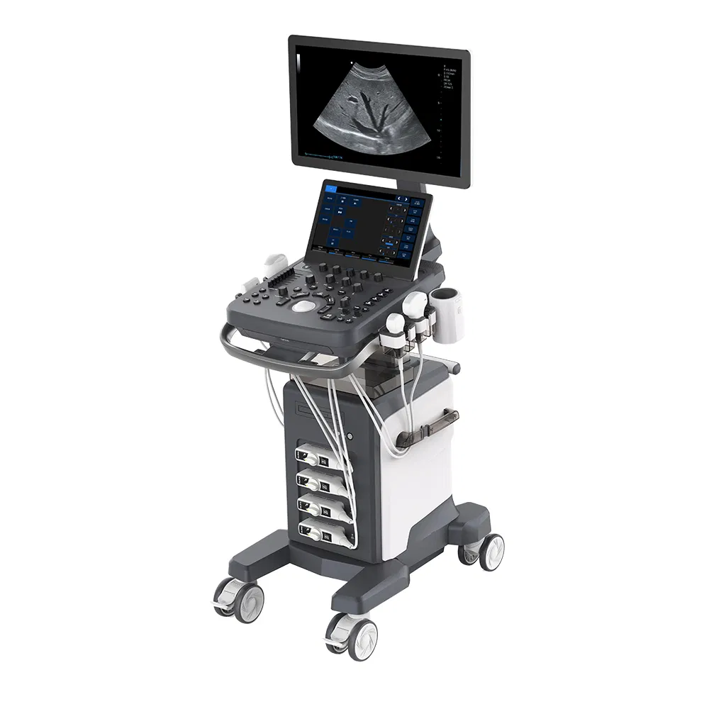 Ltub78 Trolley Full Digital Intelligent Human Ultrasound Color Doppler Ultrasound System