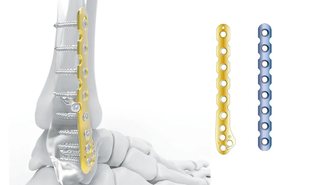 Intramedullary Nail System 2