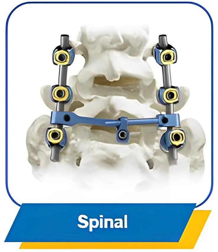 Spinal System