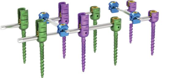 Hospital Medical Device Orthopedic Implant Spinal System (Double Core and Double Thread Type)