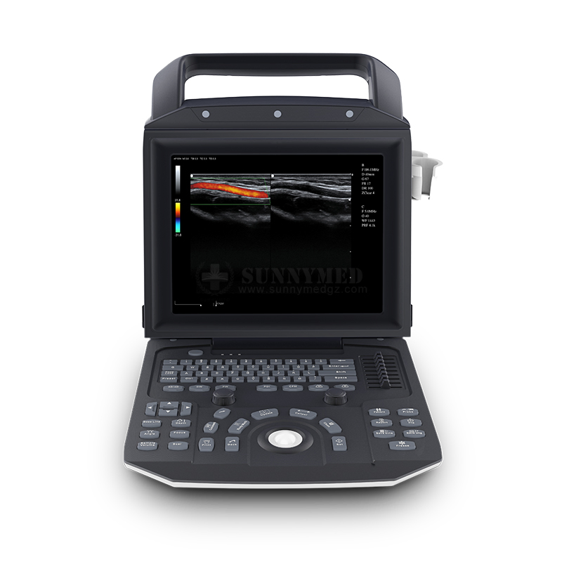 Sya-M5 3D 4D Color Doppler Laptop Cardiac Ultrasound System