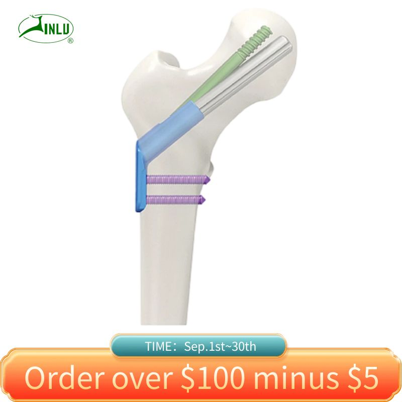 Orthopedic Implant Femoral Neck Dynamic Cross Screw System