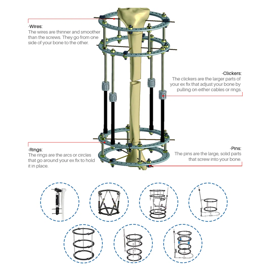Bone Correction Fixation