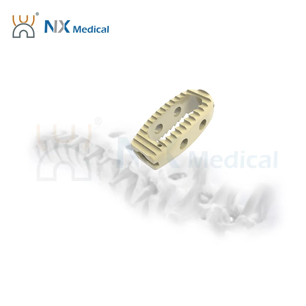 Nx Medical OEM/ODM Support Spine Implant Lumbar Cage System for Spinal Surgery