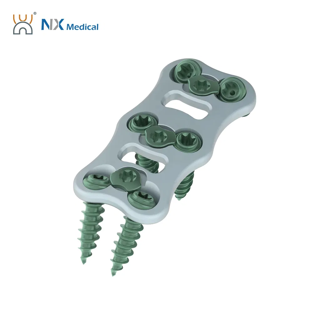 Nx Medical Anterior Cervical Plate System Spine Internal Fixation Titanium OEM ODM