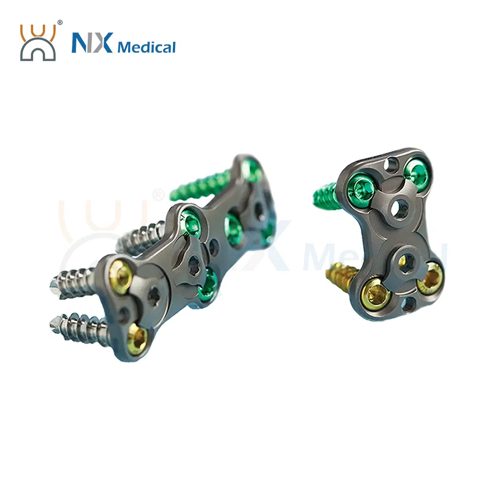 Nx Medical Anterior Cervical Plate System Spine Internal Fixation Titanium Minimum Invasive