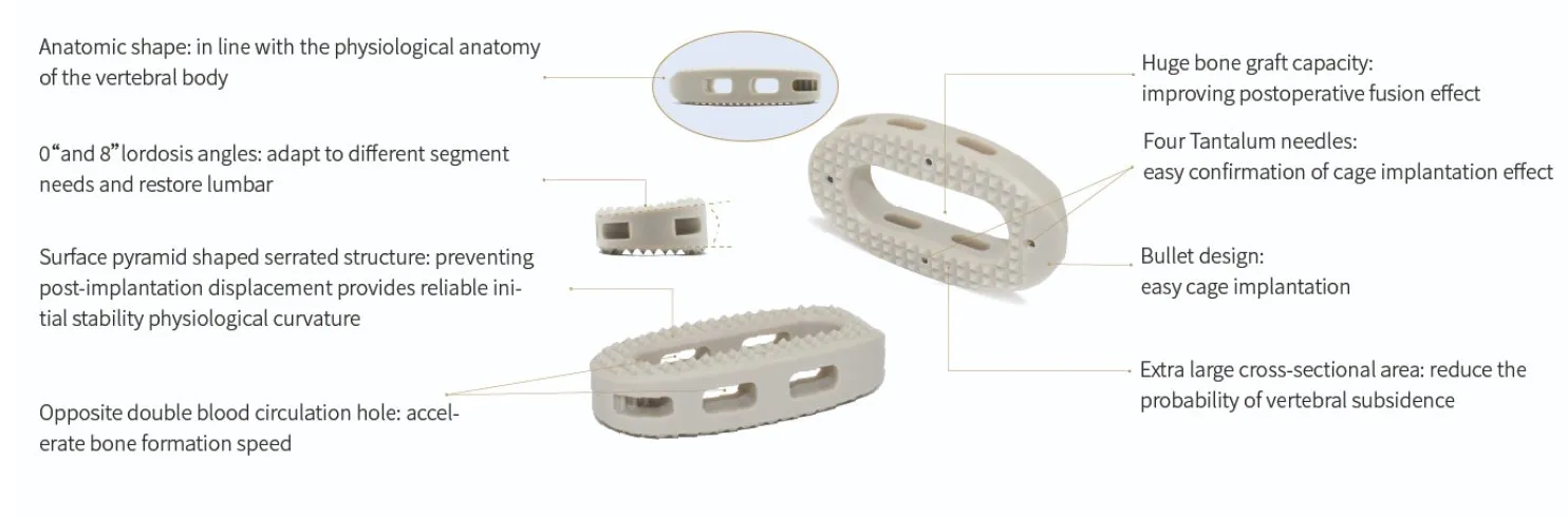 OLIF Cage Product View