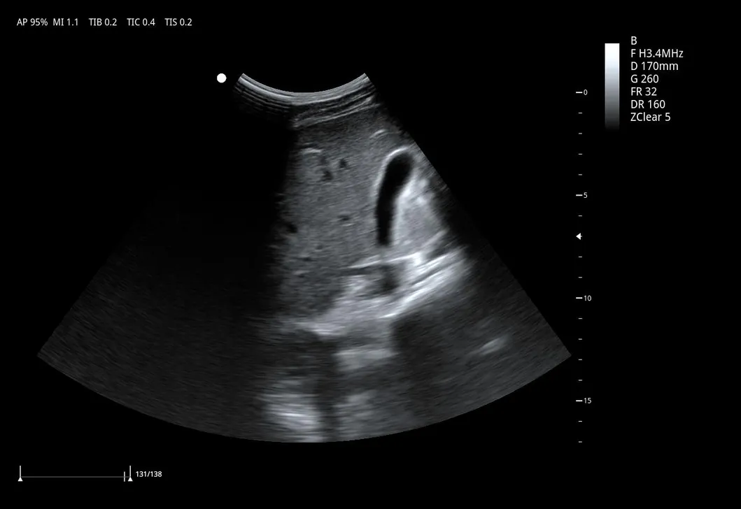 Ultrasound Detail 1