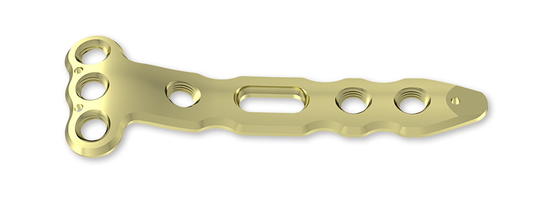 Titanium Screw and Plate Orthopedic Implant System