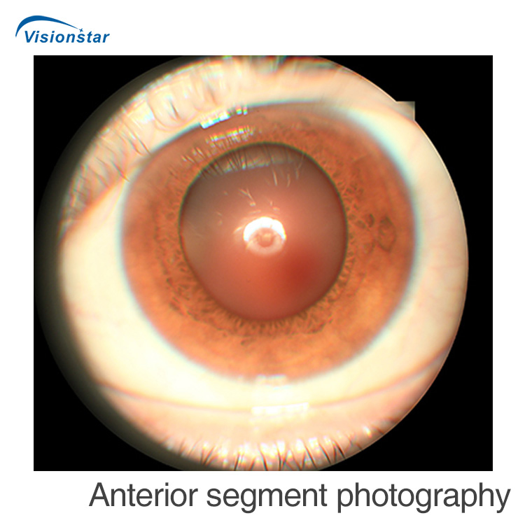 Aps-Cer (Model B) Fundus Camera &amp; Fluorescein Angiography System