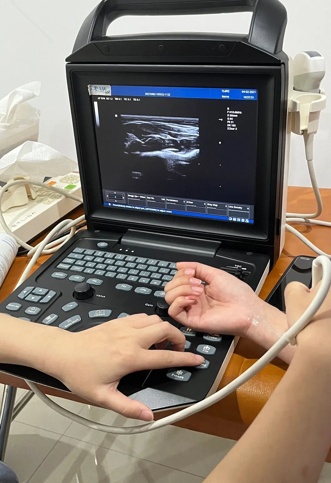 Ultrasound Interface