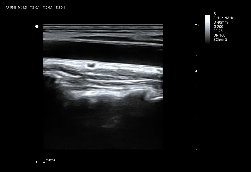 Ultrasound Detail 6