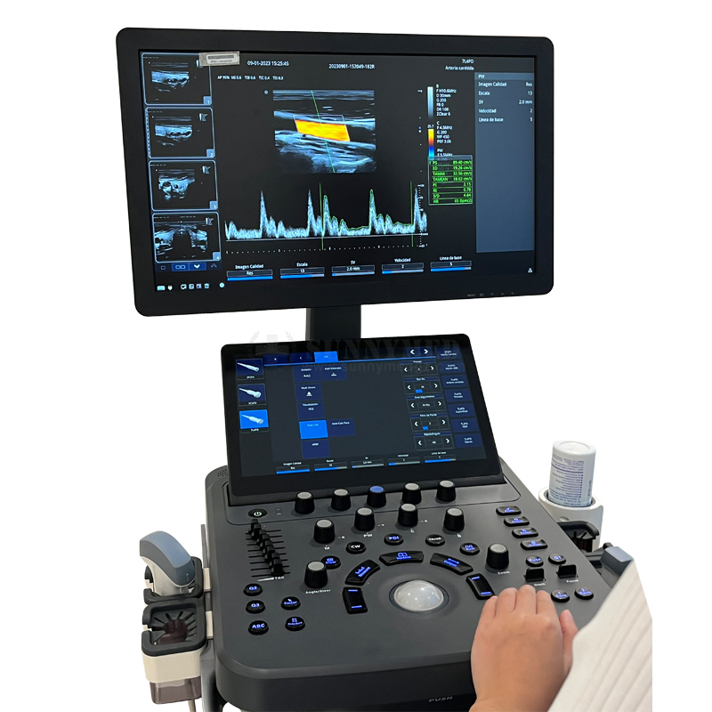 Sya-D40 Obstetrics 4D Gynecology 4 Activated Transducer Ports Color Doppler Ultrasound System