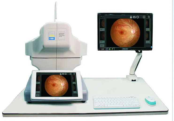 Fundus Camera View 1