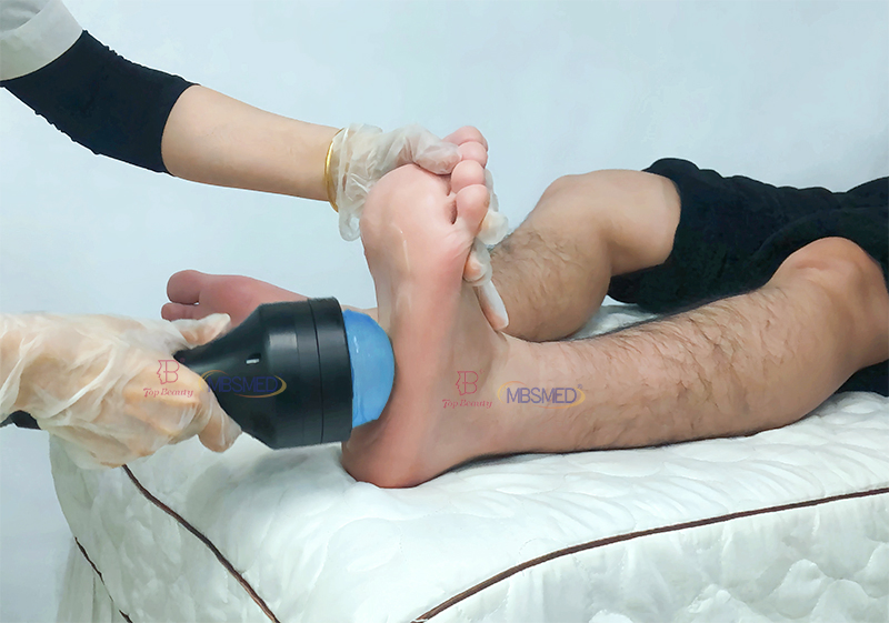 Fswt Pain Management Eswt Shock Wave Therapy System Focus Shockwave Physiotherapy Rehabilitation Equipment