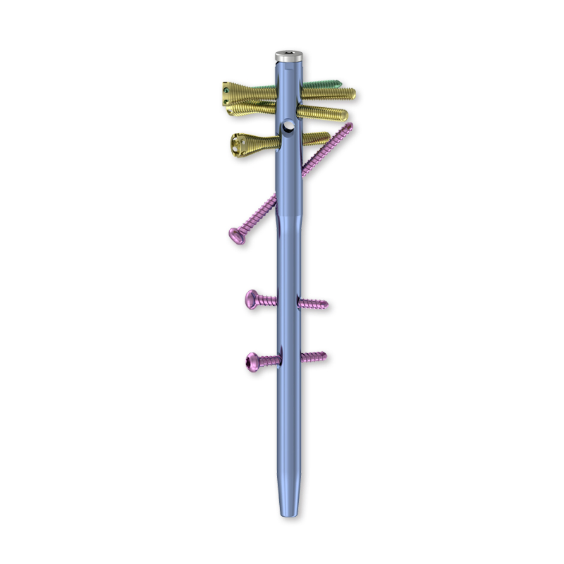 Intramedullary Nail System with Blade Locking
