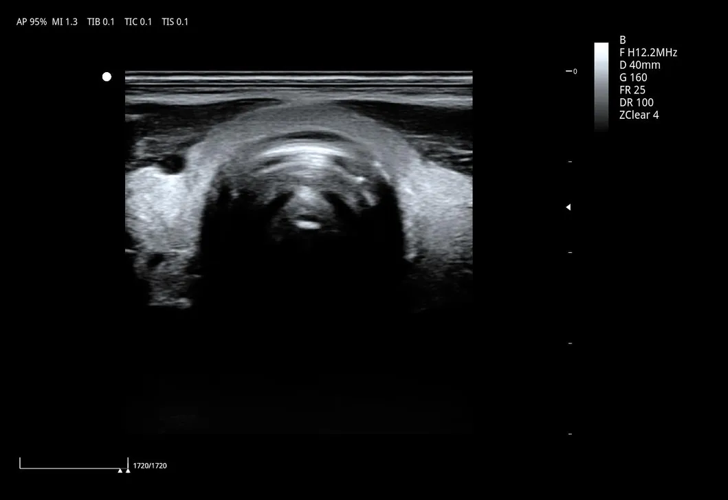 Ultrasound Detail 4