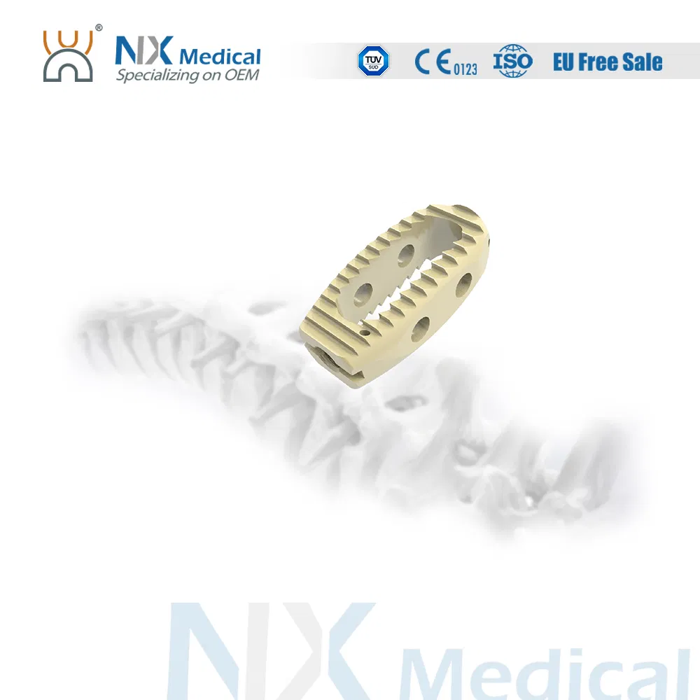 Nx Medical OEM/ODM Support Orthopedic Implant Lumbar Cage System for Bone Fixation