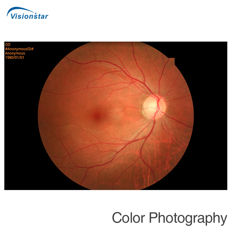 Aps-Cer (Model B) Fundus Camera &amp; Fluorescein Angiography System