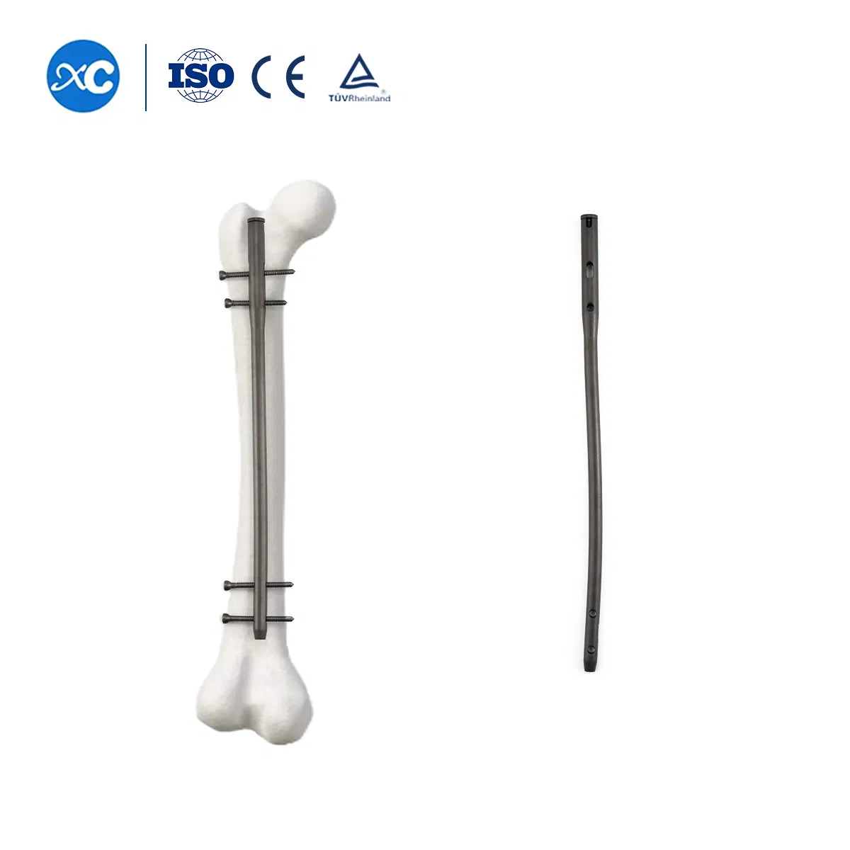 Xc Medico Intramedullary Nail System Reversed Femoral Intramedullary Nail