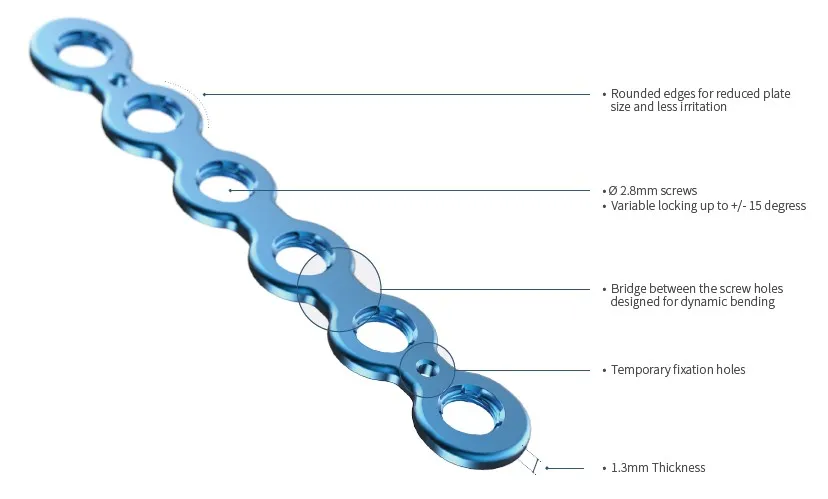 Trauma Plate System 1