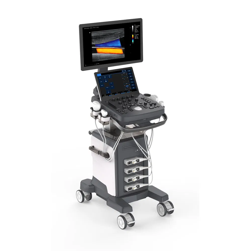 Ltub78 Trolley Full Digital Intelligent Human Ultrasound Color Doppler Ultrasound System