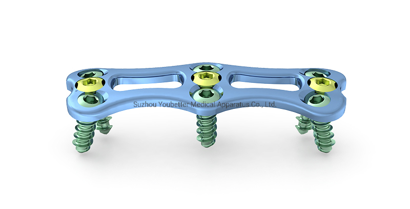 Polyaxial Spine Screw System with Locking Plate for Orthopedic Implants