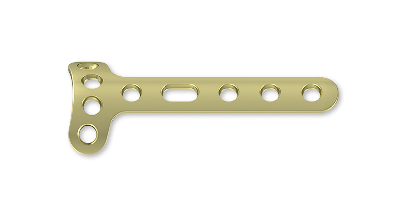 Surgical Equipment Orthopedic Implant Titanium Plate System