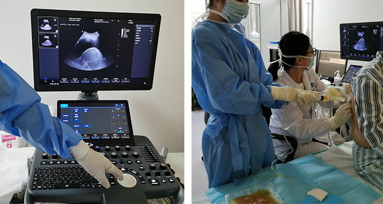 Full Digital Color Doppler Ultrasound System with 5 Ports