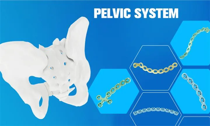 Pelvic Plate Bone Plate Orthopedic Implant System