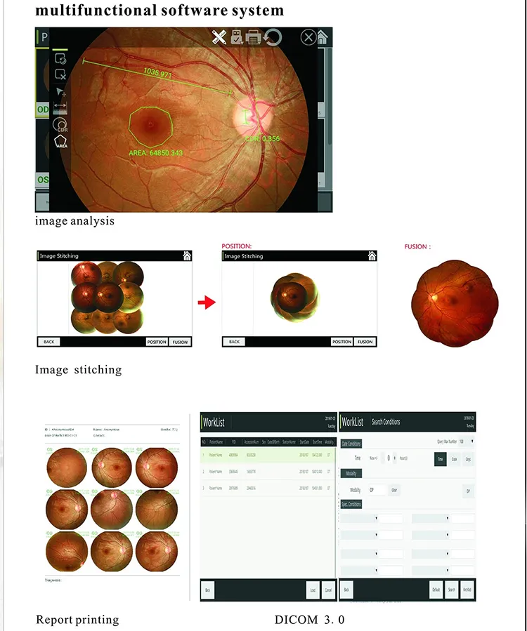 Fundus Camera View 6