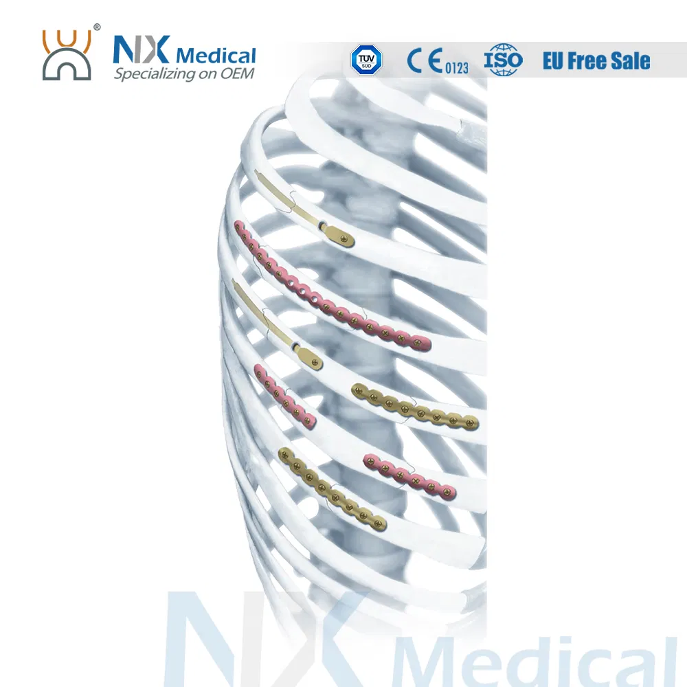 Bone Fixation Variable Angle Locking Plate LCP Rib 2.9mm System for Trauma Fixation