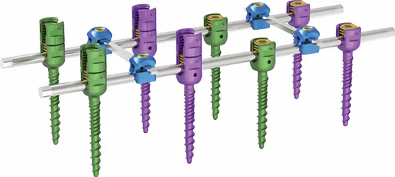 Spinal System Crosslinks Components