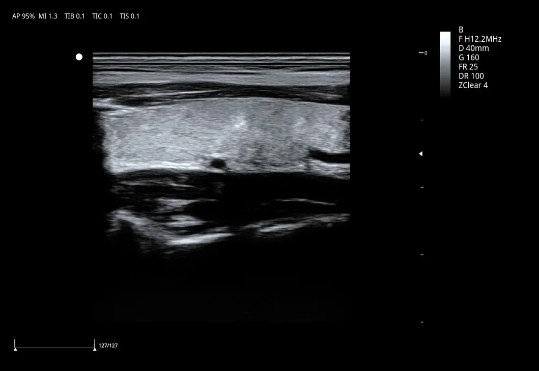 Ultrasound Detail 5