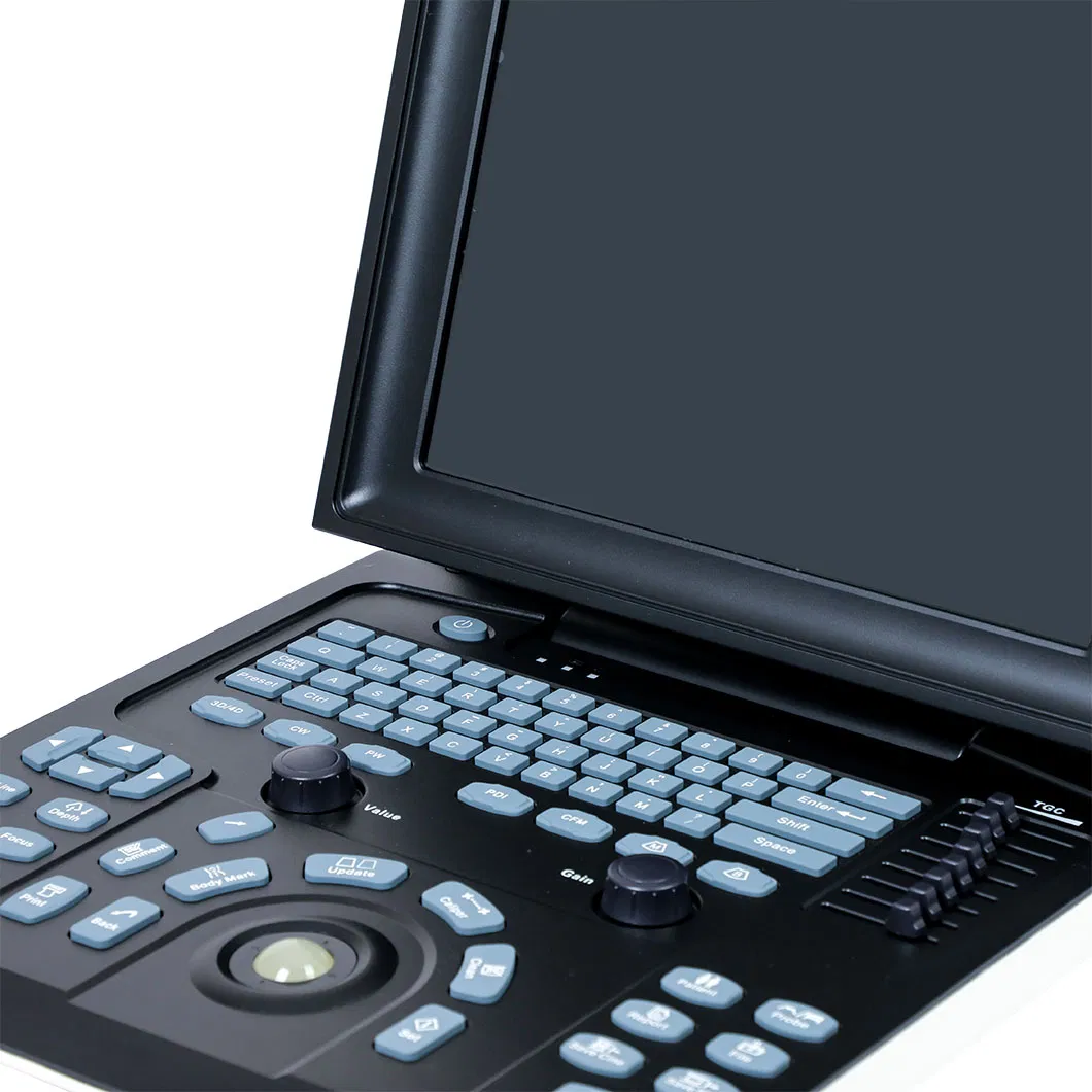 Portable Medical Ultrasonic Ecografo Color Doppler Laptop Cardiac Ultrasound System