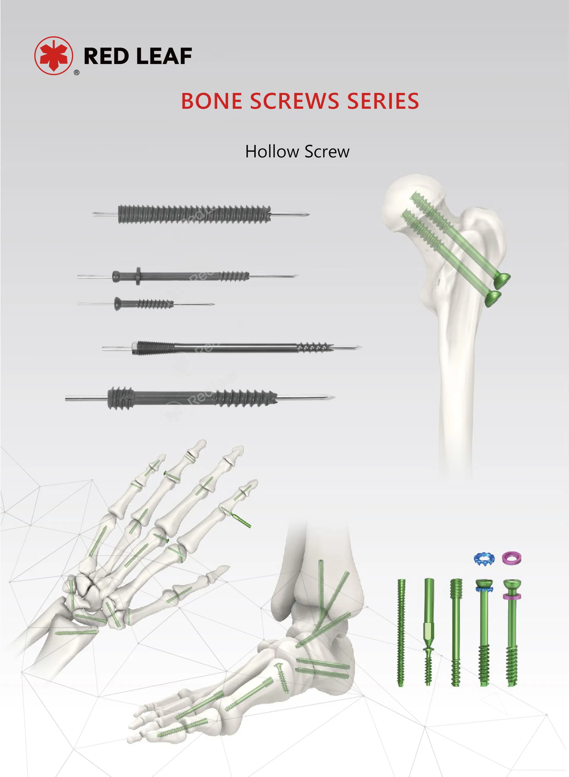 Orthopedic Implant Specification