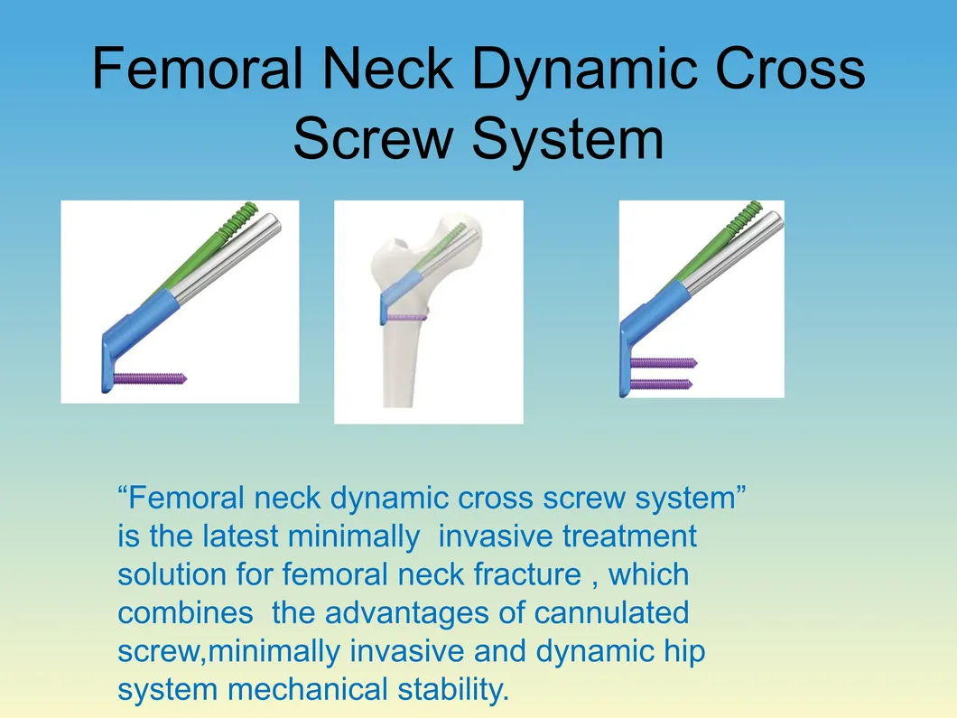 Orthopedic Implant Femoral Neck Dynamic Cross Screw System