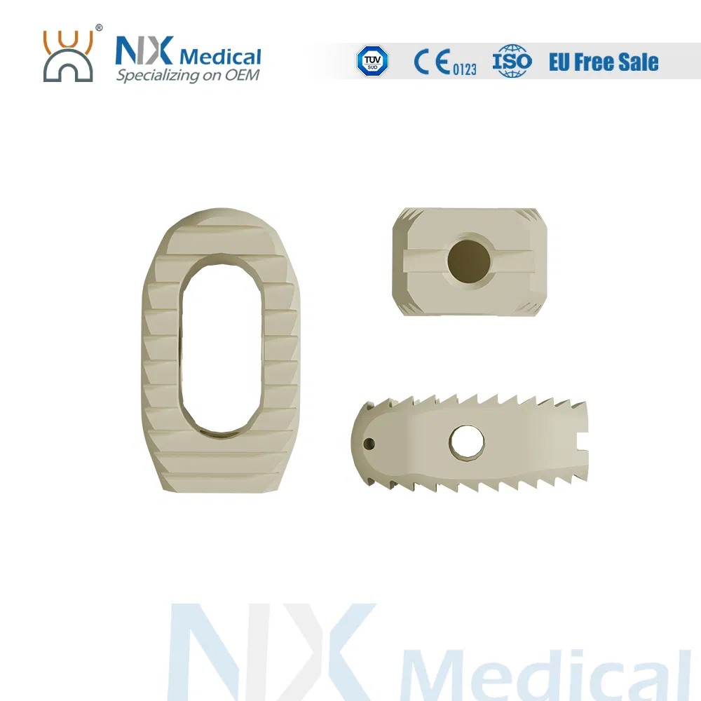 Nx Medical OEM/ODM Support Spine Implant Lumbar Cage System for Spinal Surgery