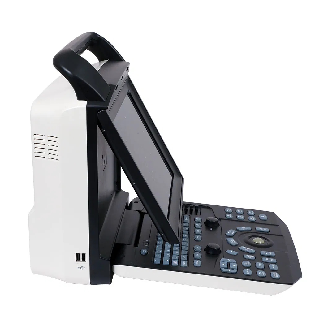 Portable Medical Ultrasonic Ecografo Color Doppler Laptop Cardiac Ultrasound System