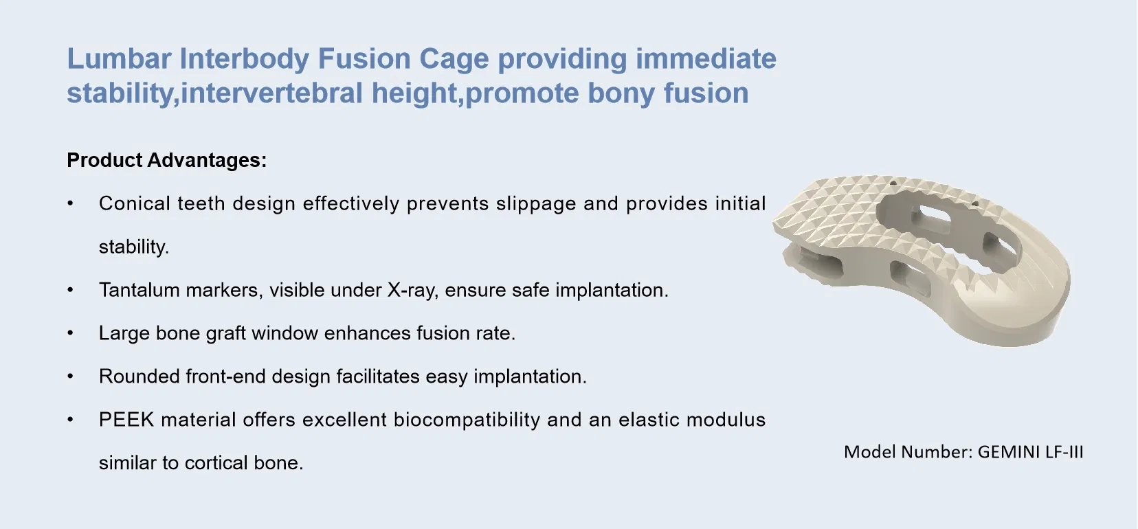 Advanced Lumbar Fusion Cage Mimicking Cortical Bone Strength