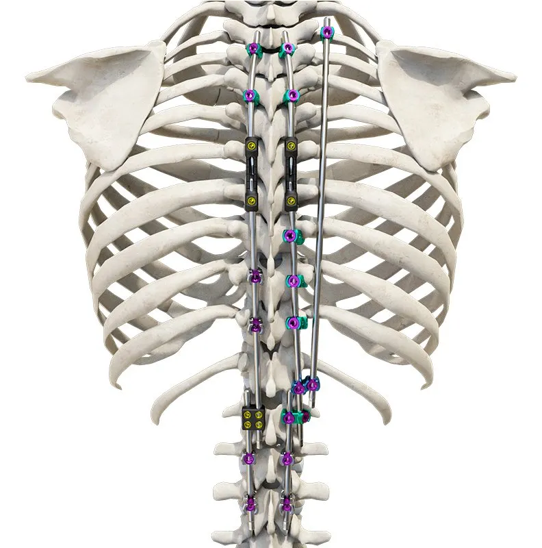 Fixation System Detail 1