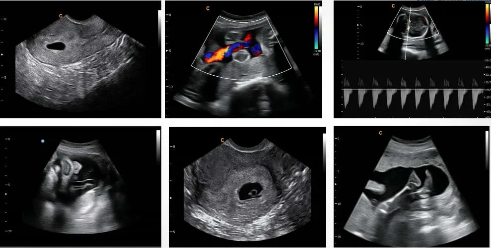 Color Doppler System Display 5