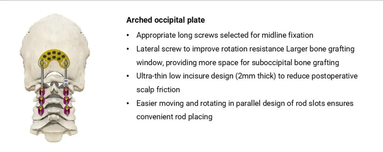 Spinal System Component 3