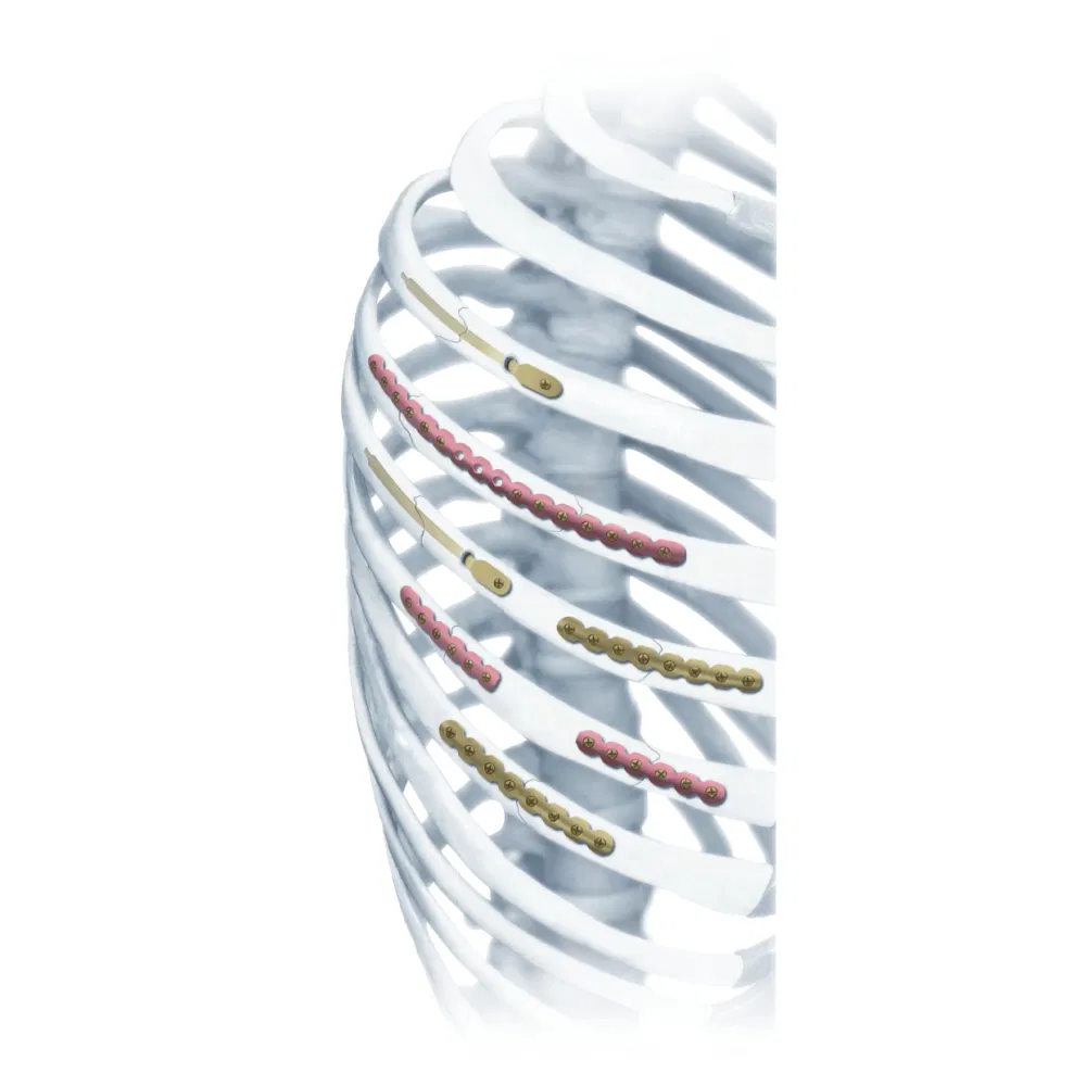 Variable LCP Rib 2.9mm Trauma Plate System for Trauma Fixation